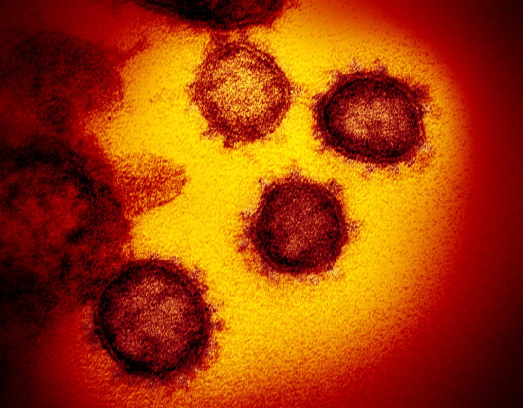 coronavirus-covid-6-1140x890